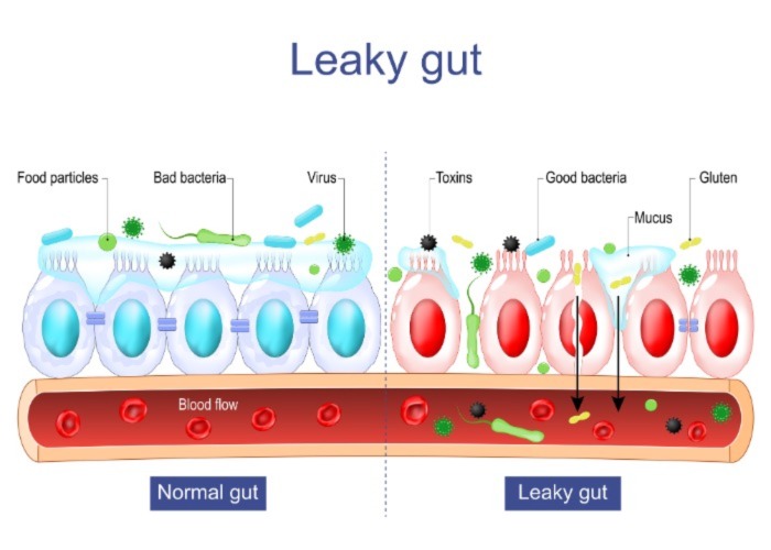 Permeabilità Intestinale: Normal Gut e Leaky Gut